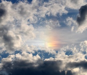 多卵泡卵巢不来月经（多卵泡卵巢不来月经怎么办）